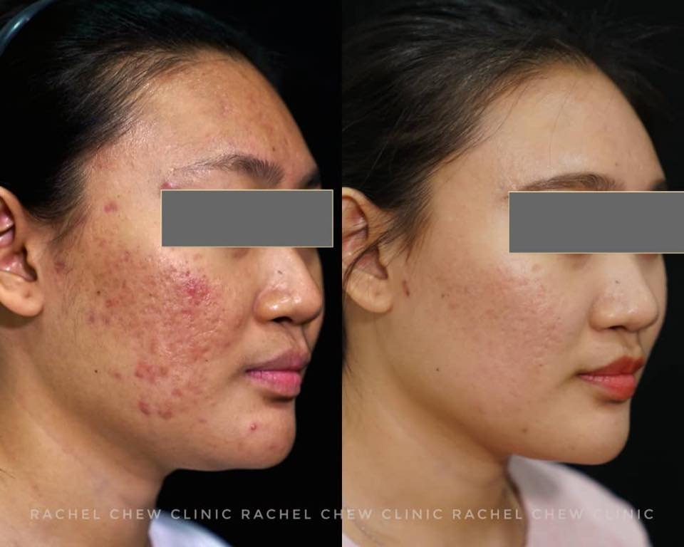 Aesthetic Clinics Klang Valley - Rachel Chew Clinic