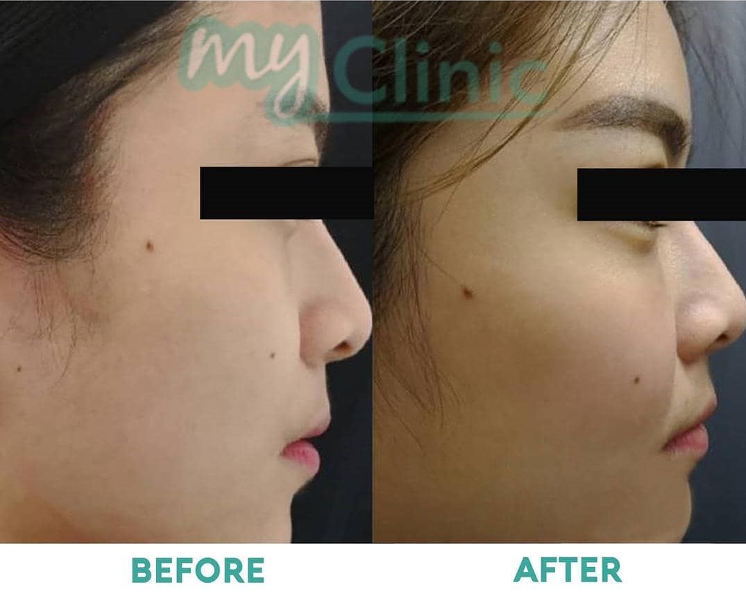 Aesthetic Clinics Klang Valley - MyClinic