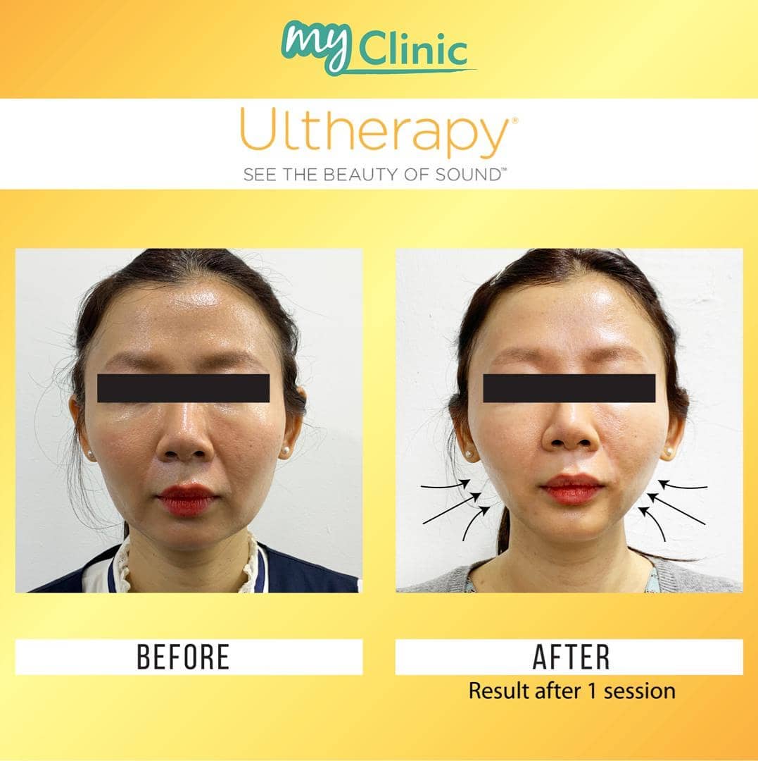 Aesthetic Clinics Klang Valley - MyClinic