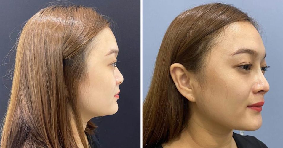 10 Certified Aesthetic Clinics In Klang Valley With Before & After Photos